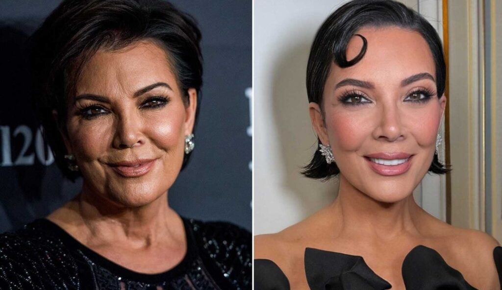 foto de antes e depois de kim kardashian