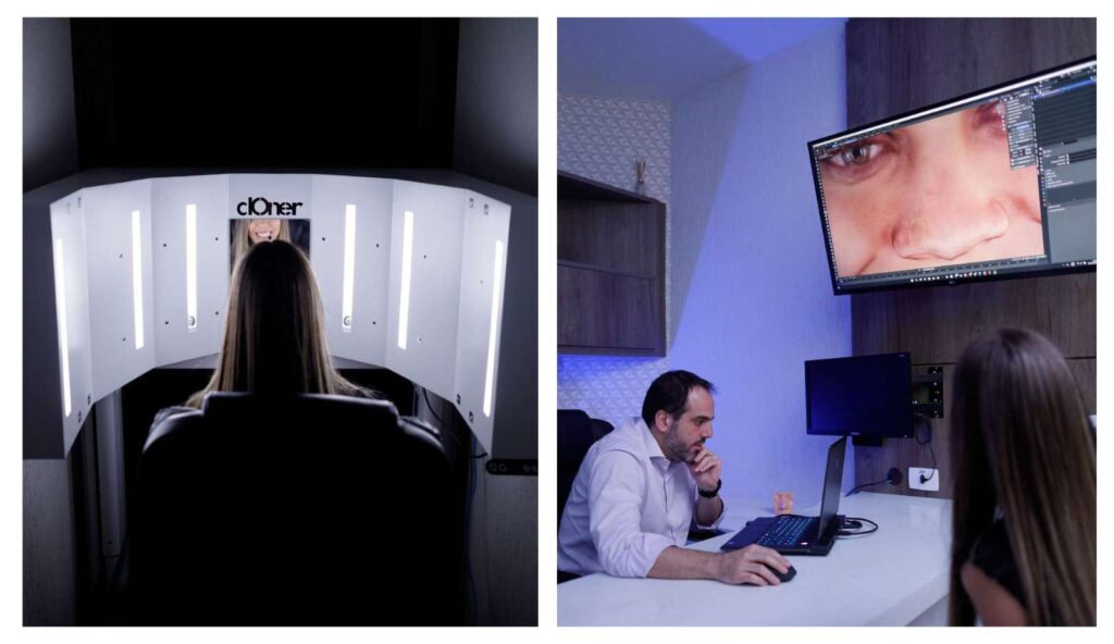 Imagem de planejamento 3D de rinoplastia em Curitiba com o Dr. Gabriel Zorron