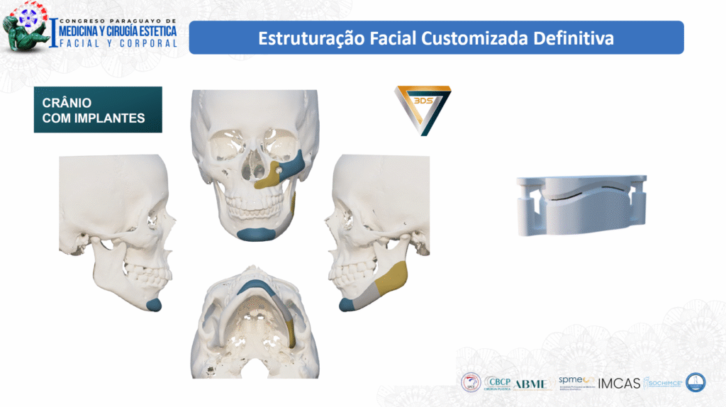 foto de slide da apresentação do Dr Gabriel Zorron, cirurgião plástico da face, no congresso paraguaio de cirurgia estética.